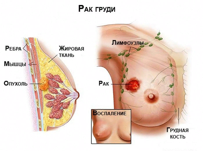 Случайные засветы голых сисек и сосков на улице