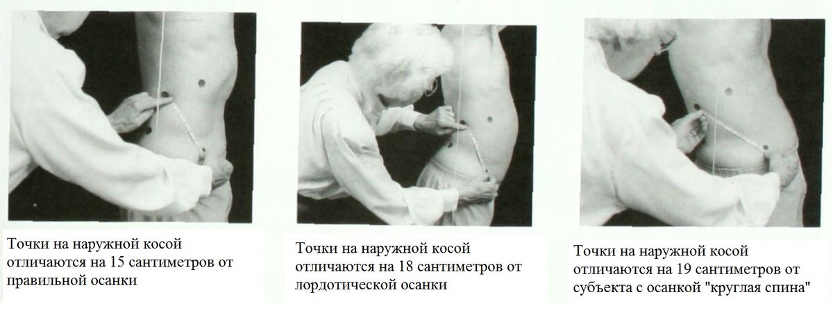 Влияние осанки на здоровье человека - Sektascience: научно-популярный журнал