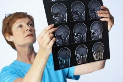 Виды головных болей и их диагностика в Международном центре охраны здоровья