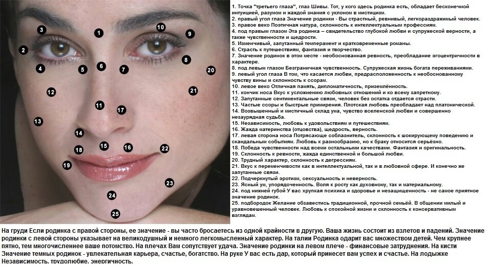 Просто о здоровье: когда родинка может стать опасной