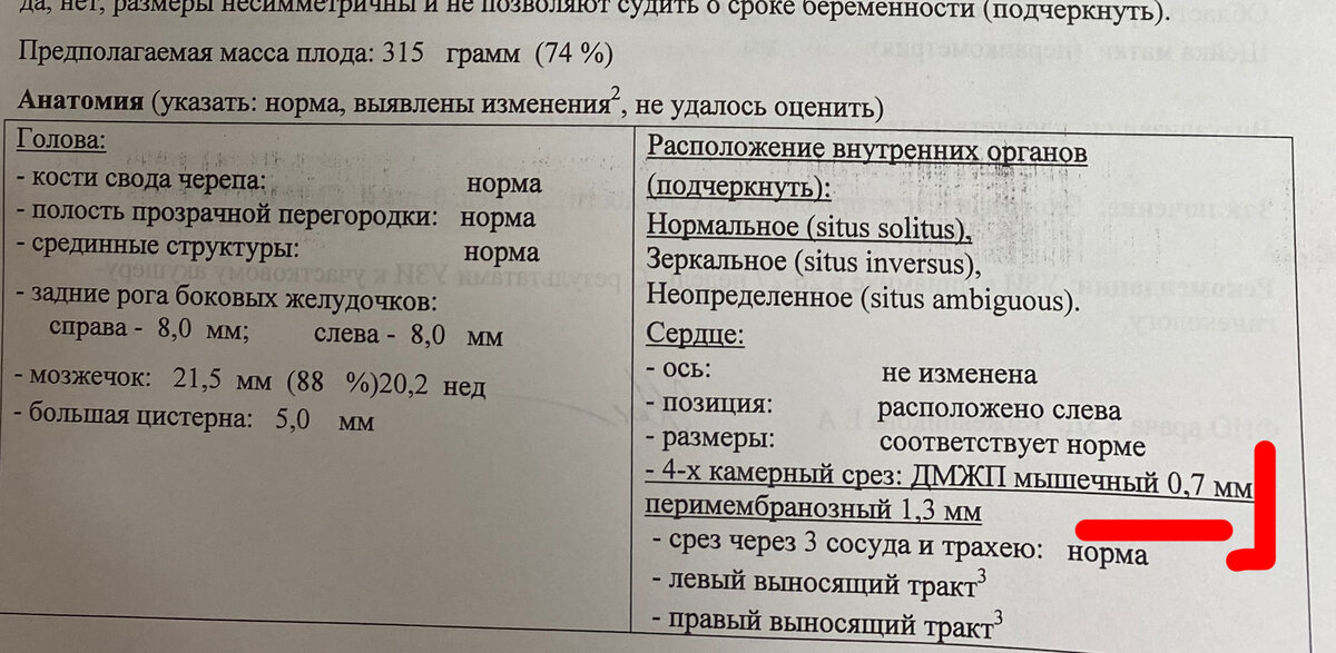 Описание узи