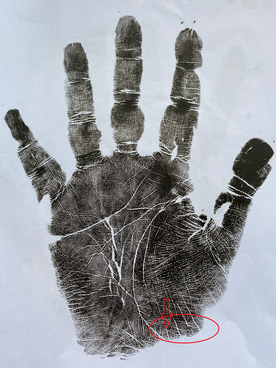 Женщина 48 лет. 3 рожденных детей. 3 аборта. 