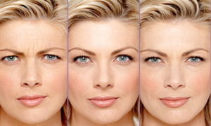 Процедура практически безболезненна и похожа на комариный укус. От десяти до пятнадцати уколов нужно на одну зону. Такие инъекции делает пластический хирург или опытный косметолог. Хороший врач знает, что действовать необходимо не только на мышцы, но и на их антагонисты. Они кожу смещают в противоположную сторону. Тогда мышцы не опустятся, а лицо будет ровным. Анестезия не нужна, перед уколами положат лишь холодный пакет.