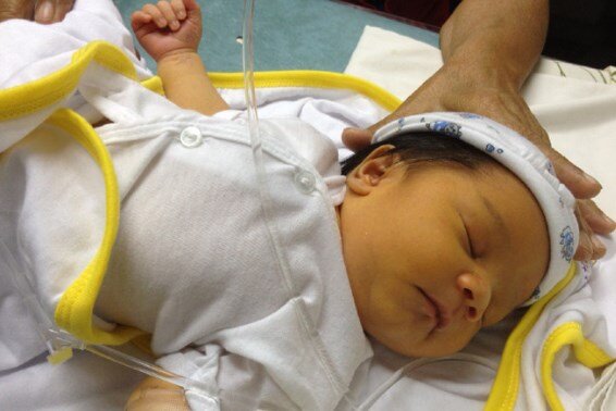желтуха у новорожденных