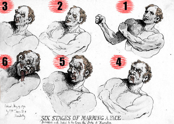 Шесть стадий изменения лица в ходе боя. Художник Томас Роулендсон, 1792 г.