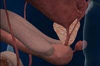   Следует отметить, что простатит у мужчин может протекать с ярко  выраженными признаками или практически бессимптомно. Многие мужчины  совершают большую ошибку: заметив некоторый дискомфорт в области малого  таза, принимаются самостоятельно лечить недиагностированное заболевание.  Делать этого категорически нельзя, потому что простатит может стать  хроническим при несвоевременном и неправильном лечении. 