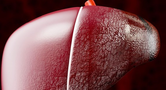 фото: https://www.medicover.pl