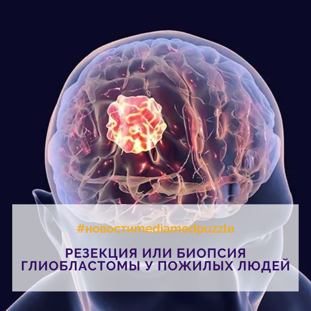 49. Роль хирургической резекции у пожилых людей с <b>глиобластомой</b> является сп...