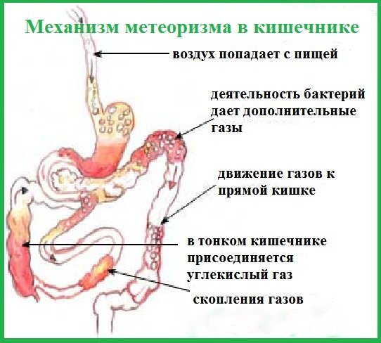 Вздутие живота. Что делать?