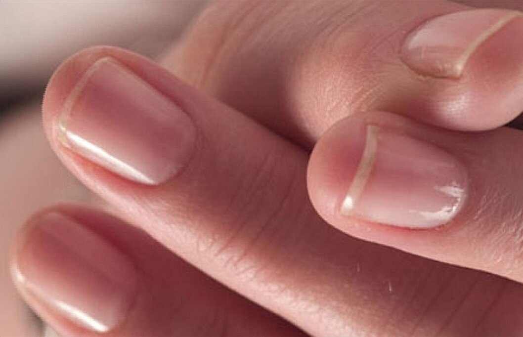 Что делать если ногти мягкие. Формы ногтей. Красивые ногти без покрытия. Натуральные ногти. Квадратная форма ногтей без покрытия.