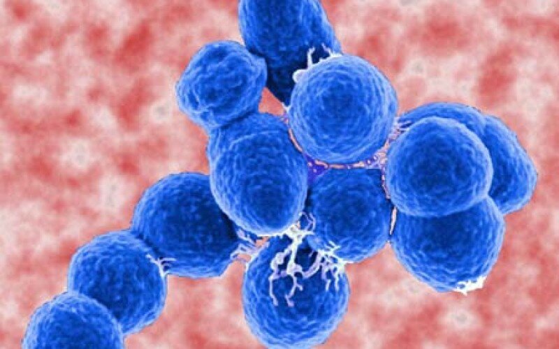 Есть защита???