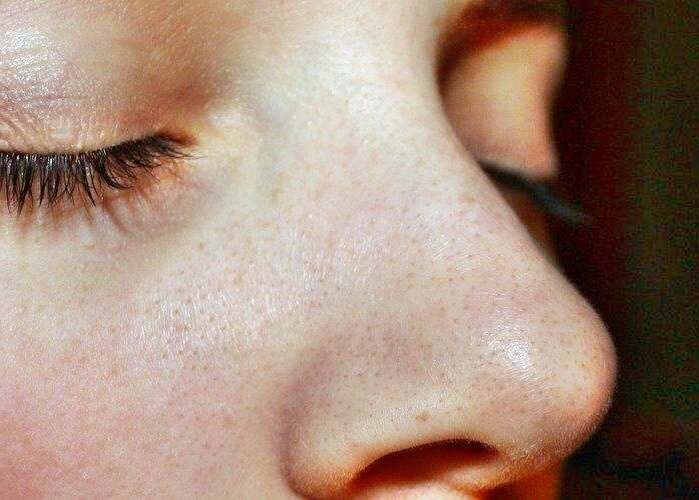 Как правильно очистить кожу на носу?