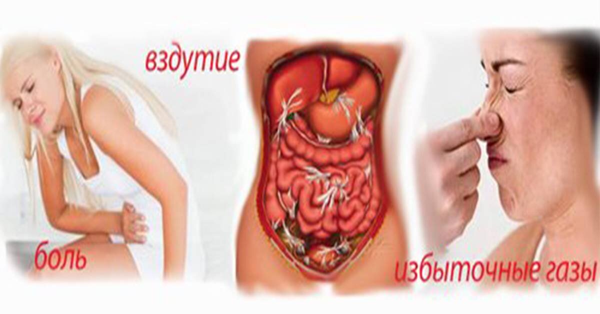 Газообразование - это очень не приятные ощущения. Источник фото - https://clck.ru/eppEd