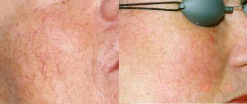  Результат лечения