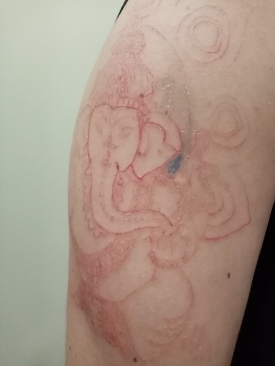 Спустя две недели, после нанесения красного контура