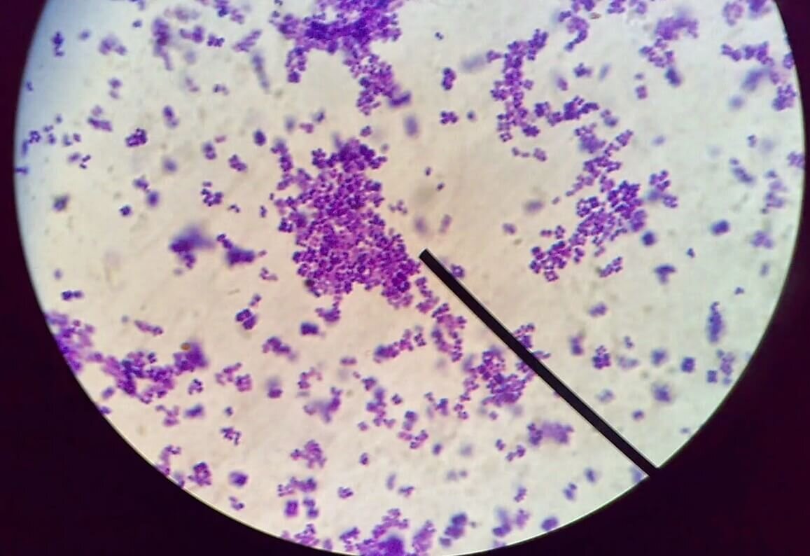    Стафилококки под микроскопом