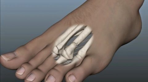  Способы определения травмы голеностопа