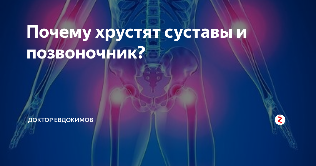 Хрустят суставы по всему телу причины. Хруст позвоночника и суставов. Почему хрустит позвоночник. Хрустеть спиной