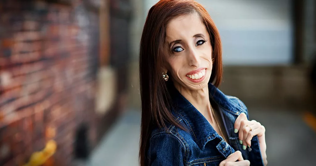 Некрасивые женщины. Элизабет «Лиззи» Веласкес. Лиззи Веласкес Lizzie Velasquez.