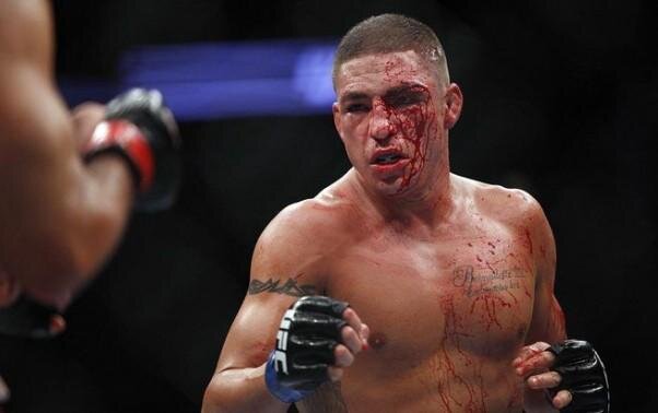 
36-летний ветеран UFC Диего Санчес провел 38 боев в своей долгой и зрелищной карьере, две трети противостояний прошло под эгидой сильнейшей организации мира. Санчес устраивал исторические мясорубки, падал на канвас без сознания и совершал апсеты на протяжении многих лет. И он до сих пор хочет стать чемпионом. Нет сомнений, что такой воин, как Диего, искренне верит, что добьется этой цели: