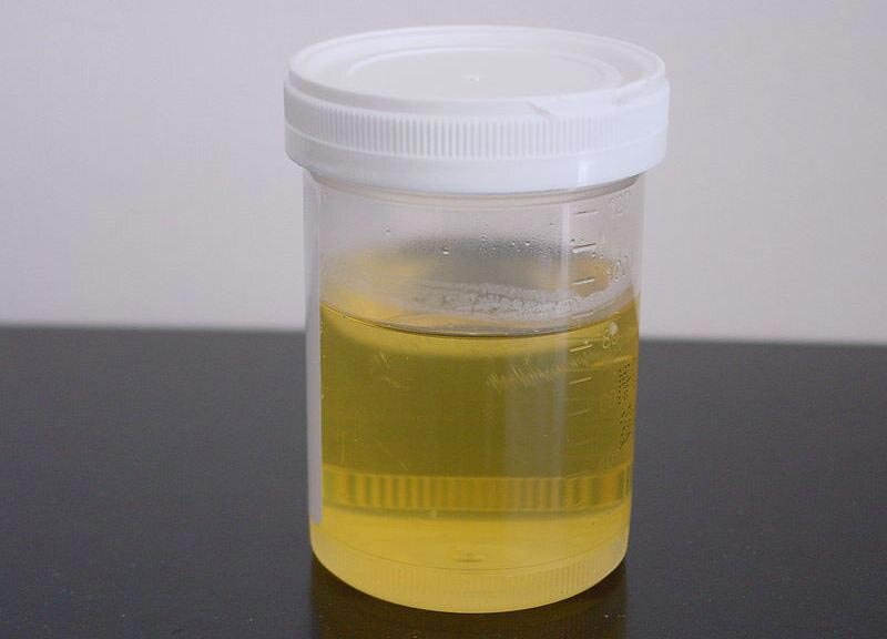 светлая моча. темно желтая моча. цвет здоровой мочи фото. цвет здоровой мочи фото. цвет здоровой мочи фото.