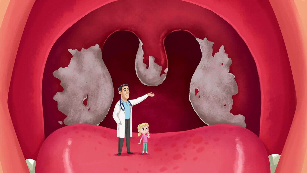 Ребенком я не понимала, как они меня спасли, как не дали микробам размножиться и завладеть другими органами. 