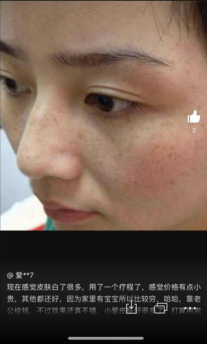 До/после➡️ Все фото взяты с Тао.