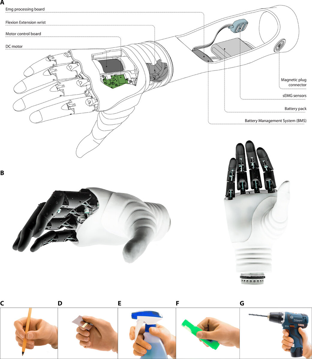 Рука помощи: как устроен бионический протез