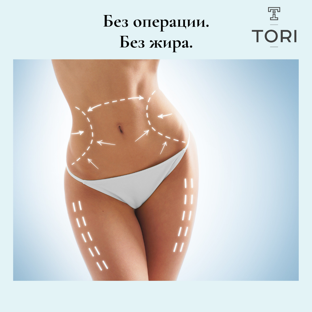 Жир, уходи! Безоперационные процедуры. Топ 5 | Tori Clinic | Дзен