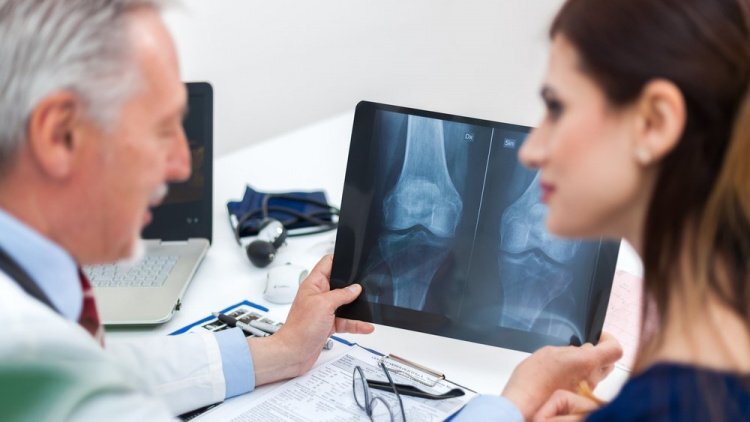 Остеопороз - хроническое заболевание, характеризующееся потерей плотности костной ткани, которое развивается у людей после 40-45 лет. В группе риска - женщины в период менопаузы