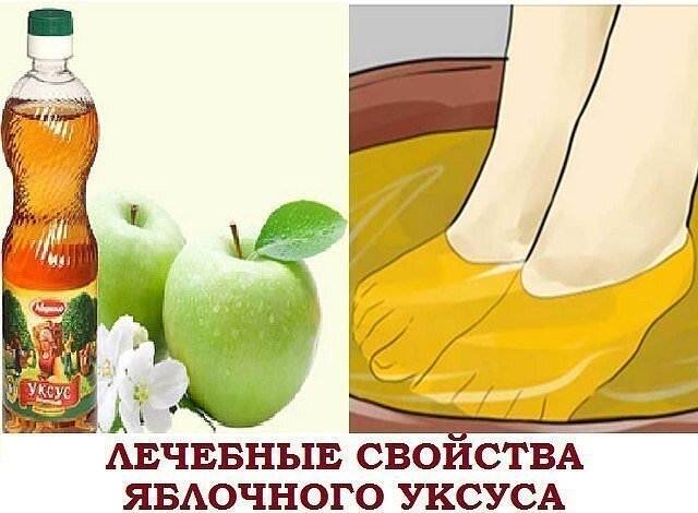 Может ли яблочный уксус лечить подагру? – Drink-Drink