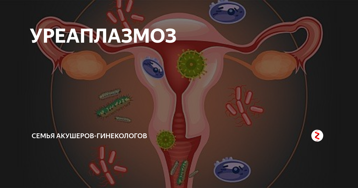 Уреаплазмоз - причины, как передается, симптомы, признаки, диагностика, лечение