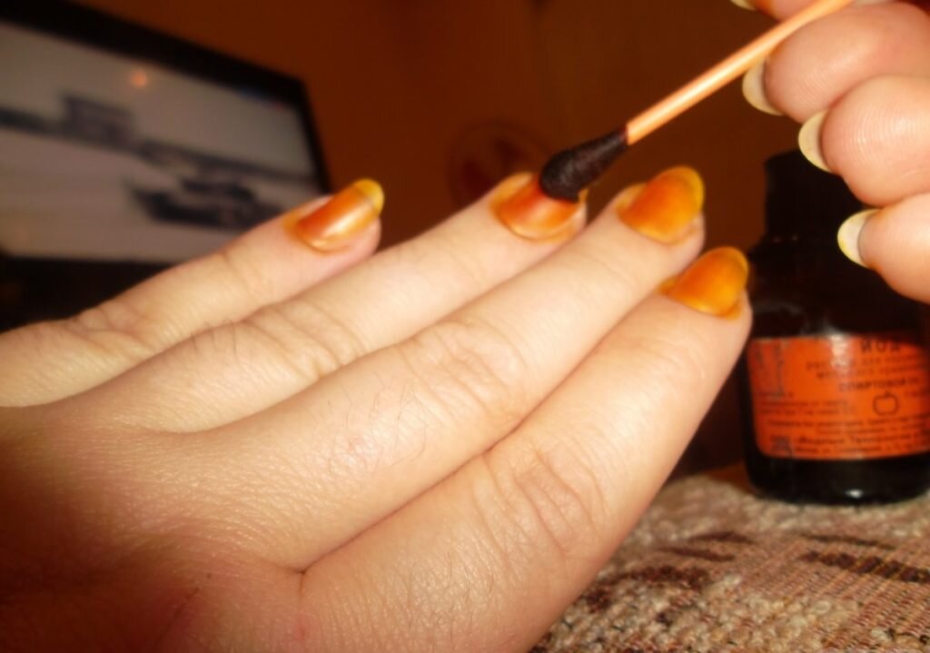 Изображение взято из http://nogi.o-gribke-nogtej.ru/wp-content/uploads/2018/03/Pi6FXPqozFmRQ1SdSrhKQ-1024x719-8.jpg