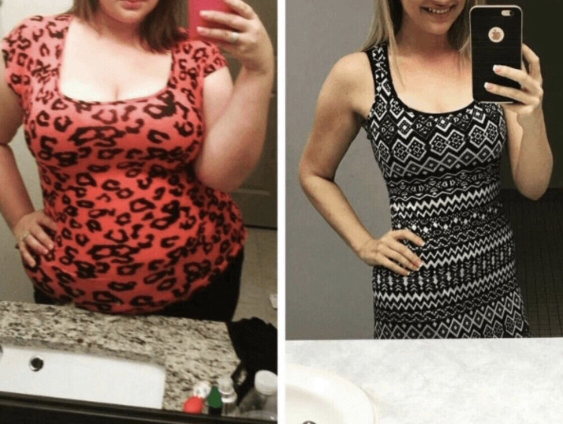 Мои фото ДО и ПОСЛЕ (спустя 3 месяца) 