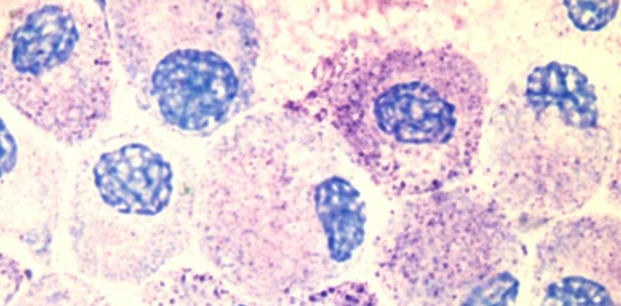 Тучные клетки (foto: wikipedia.org)