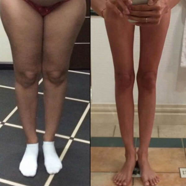 -2