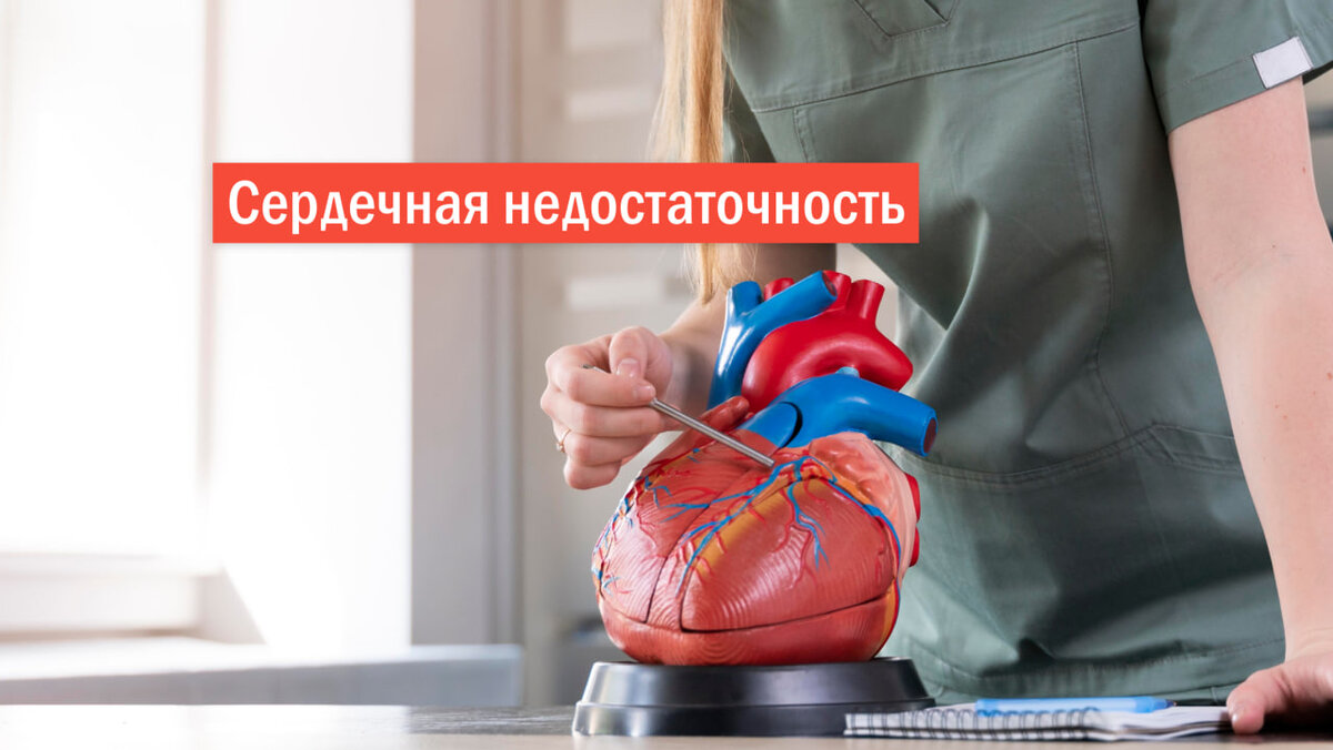 Сердечная недостаточность — это заболевание, при котором развиваются застойные явления в большом и малом круге кровообращения вследствие нарушения сократительной способности сердца.