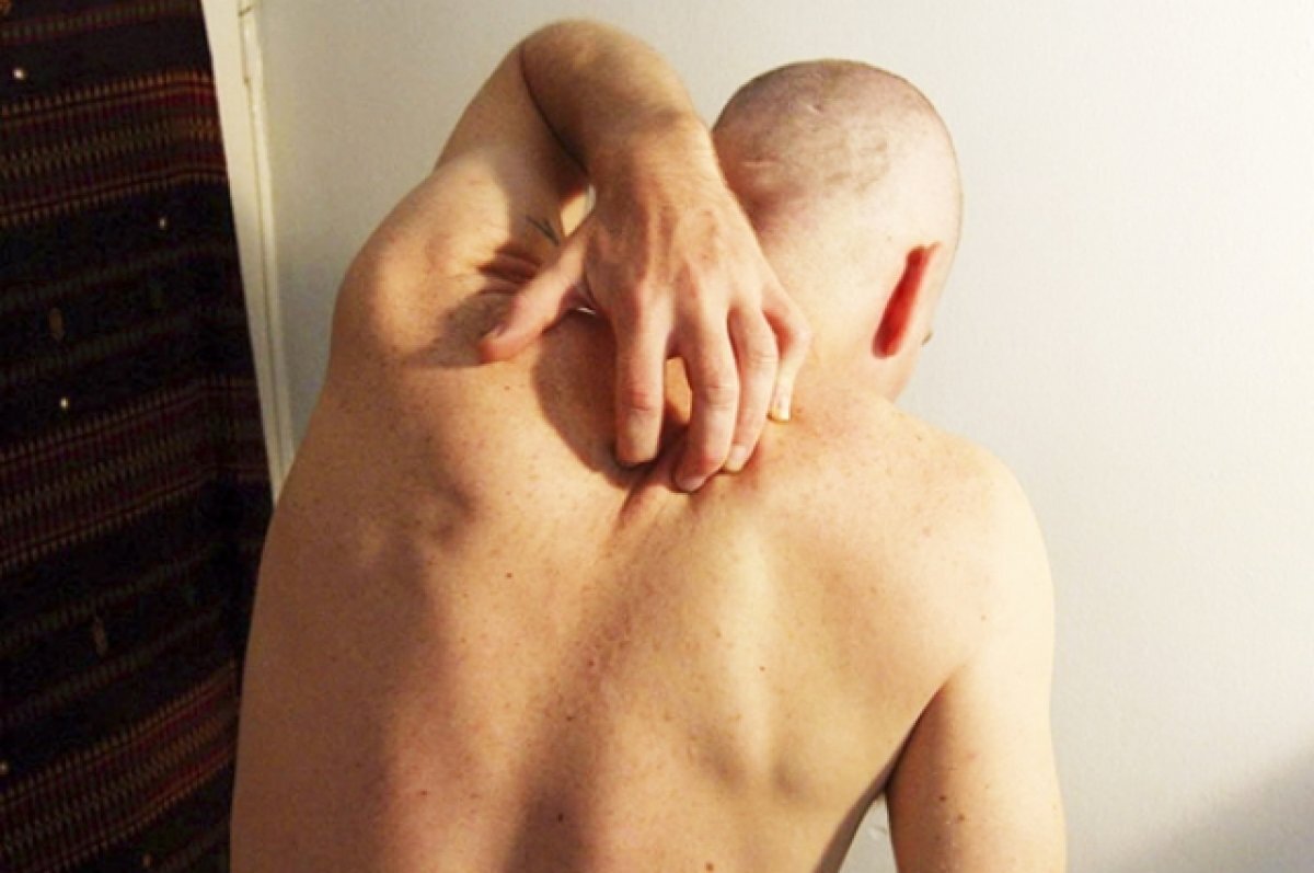    В доме милосердия в Новосибирской области обнаружили чесотку