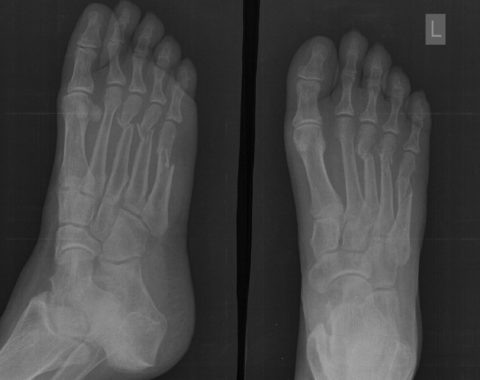  Фото: повреждения голеностопа