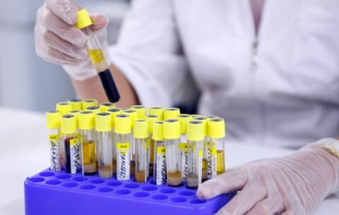  Анализ на ТТГ имеет большое значение для оценки работы щитовидной железы