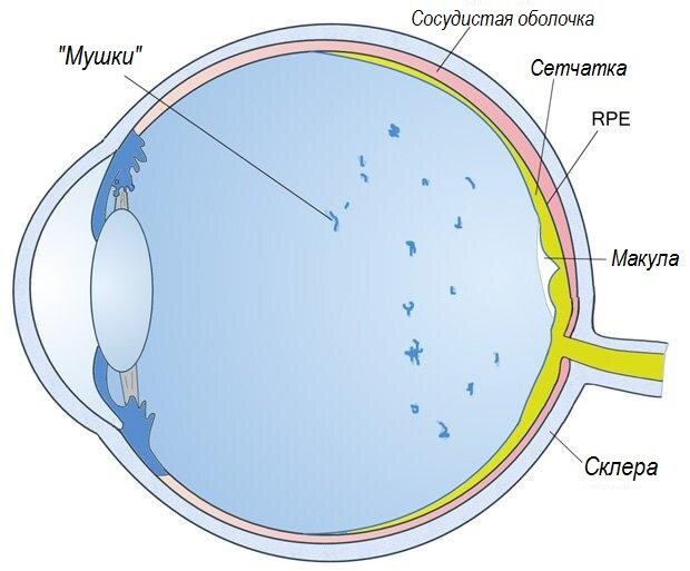  У близоруких людей "мушки" возникают гораздо раньше и чаще, чем у здоровых или дальнозорких.