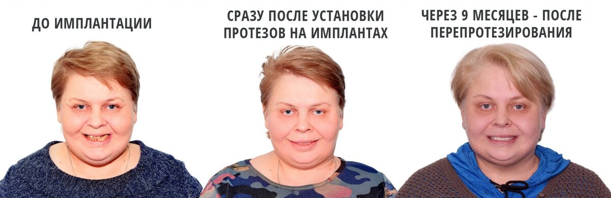 Стоматолог хирург хорев. Иби клиник. Ихн со ран. Институт базальной имплантации зубов в москве цена отзывы. Институт базальной имплантации в москве отзывы.