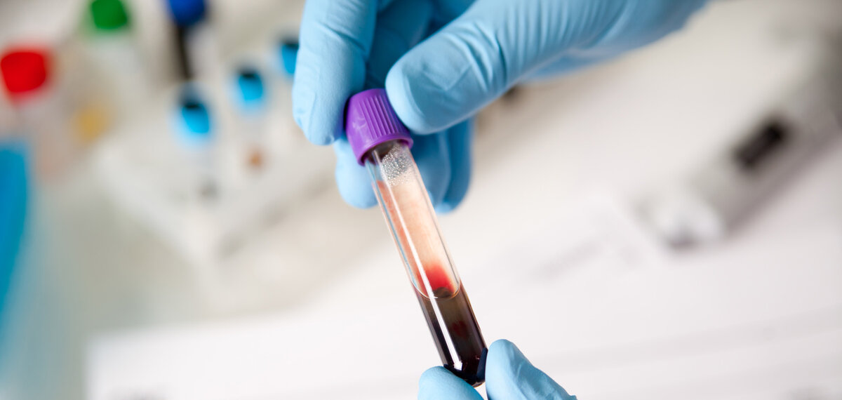 Около 55% крови составляет плазма, а остальные 45% — клетки, которые перемещаются по кровеносной системе благодаря плазме.