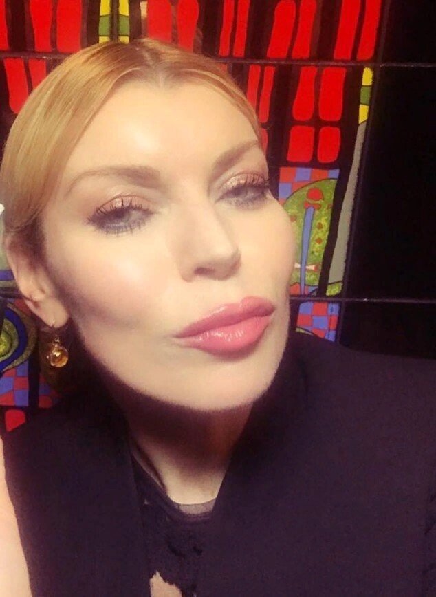 Лада Дэнс после неудачной контурной пластики губ