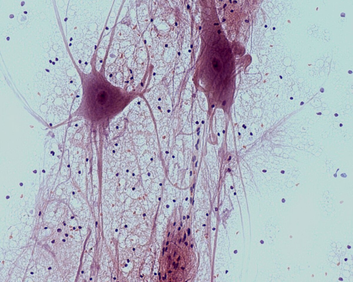 Клетки нервной ткани гистология
