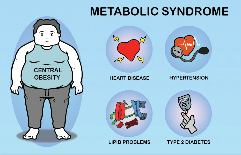 Метаболический синдром. Ожирение и метаболический синдром. Метаболический синдром у женщин. Метаболический синдром картинки. Метаболический синдром осложнения.
