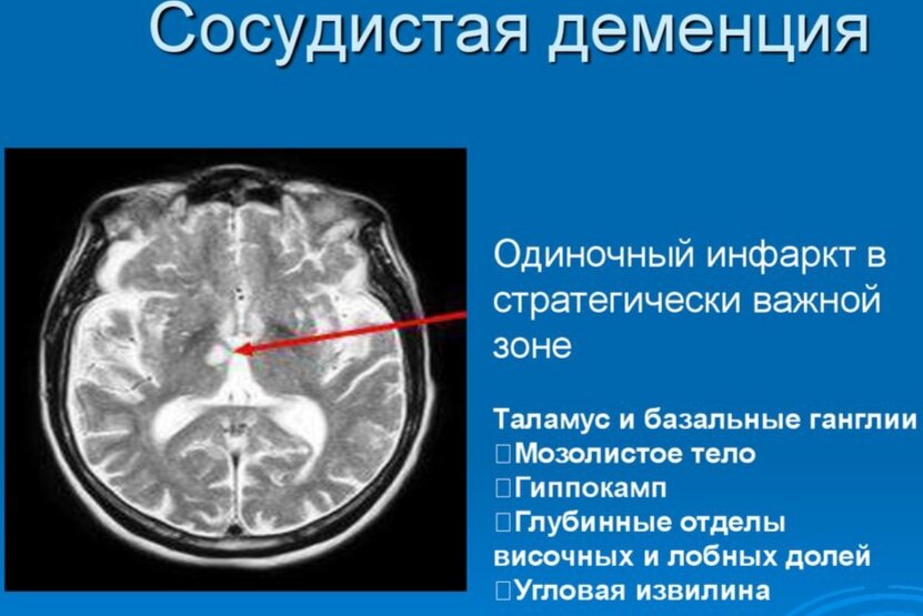 Восстановление после инсульта: как в Севастополе работает отделение медицинской реабилитации