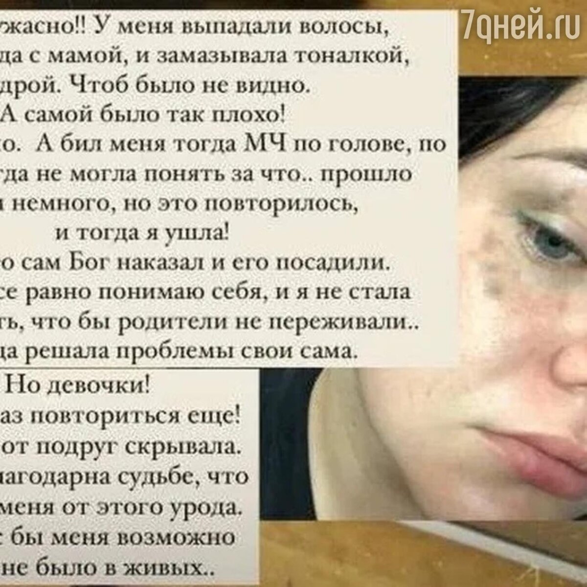 Коляда Инна. "Это не грим!" Актриса Инна Коляда пытается восстановиться после же