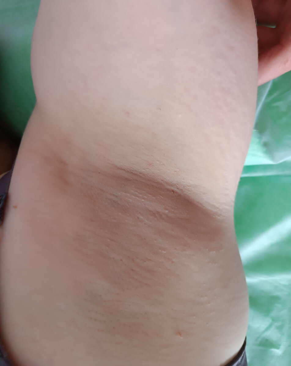 Моя подмышка) Фотоотчет