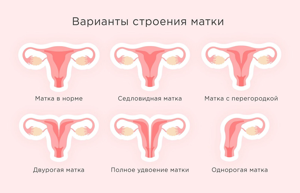 Симптомы двурогой матки